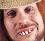 Hillbillyteeth